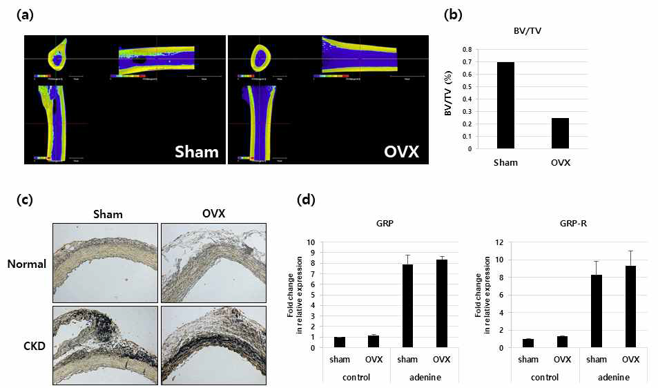 골다공증과 혈관석회화가 동시에 유도된 동물모델의 혈관에서 GRP의 역할을 확인하고자, 외과적 수술을 통해 rat의 난소를 절제한 뒤 adenine을 섭취시켜 골다공증과 혈관석회화를 동시에 유도하였음. Mirco-CT 결과, 경골의 골밀도와 조직부피에 비례한 해면골량이 난소절제 모델 (OVX) 에서 현저히 감소 되었음을 확인할 수 있었음 (A and B). 또한, 동물모델의 흉부 대동맥을 적출 하여 von kossa 염색을 시행한 결과, 골다공증과 혈관석회화가 동시에 유도된 OVX/CKD 모델에서 CKD 단일 모델보다 심각한 혈관석회화가 유도되는 것을 확인할 수 있었음 (C). 뿐만 아니라, GRP와 GRP 수용체 mRNA 발현 역시 CKD 모델과 OVX/CKD 모델에서 현저히 증가 됨을 real-time PCR을 통해 확인할 수 있었음 (D)