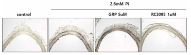 Von kossa staining을 통해 Pi에 의해서 유도된 rat 대동맥 calcification이 GRP에 의해 촉진되고, RC-3095에 의해 억제됨을 확인하였음