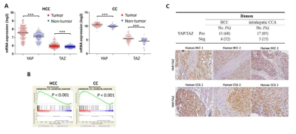 간세포암 및 담관세포암 환자에서 YAP/TAZ signaling의 활성화