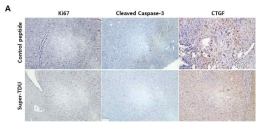 간세포암 마우스 모델에서 Super-TDU의 영향