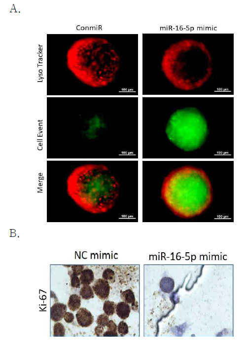 전립선 비대증 3D culture에서의 miR-16-5P의 효과