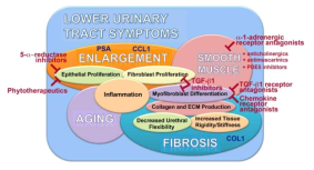 전립선비대증/ 하부요로증상 병리적 기전 및 Thrapeutic strategies. Curr. Urol. Rep. 2013:14(6)