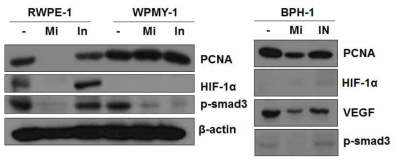 정상세포주 RWPE-1, 전립선 기질세포 WPMY-1, 전립선 비대증 세포 BPH-1에서의 전립선 비대증과 관련 있는 protein의 변화들 (Mi: miR-16-5p mimic), (In: miR-16-5p antagomiR)