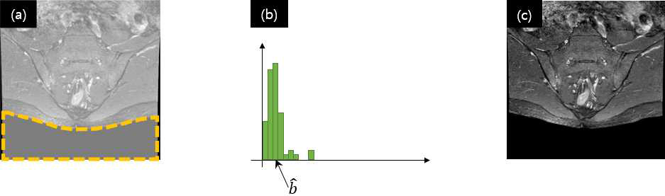 (수식) 영상 전처리 과정. (a) 원본 입력 영상 및 체외 영역 (노란 점선 내부). (b) 체외 영역 픽셀 밝기 분포도 및 밝기 왜곡 추정치  . 가로축은 밝기 값, 세로축은 빈도수. (c) 보정된 공명영상  .>