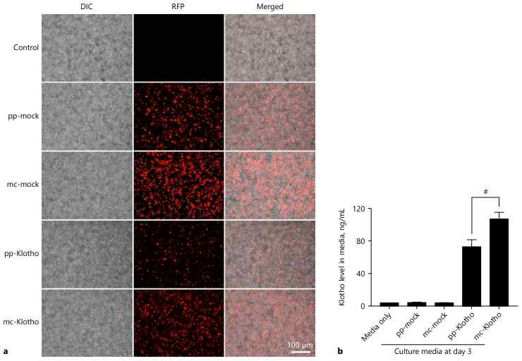 Detection of Klotho protein derived from MCs in vitro. a Fluorescence images showing the expression of RFP, encoded in each PP or MC, after 24 h post-transfection. HEK293T cells were transfected with pp-mock, mc-mock, pp-Klotho, or mc- Klotho. b Concentration of Klotho present in the conditioned media of HEK293T cells transfected with pp-mock, mc-mock, pp-Klotho, and mc-Klotho. The conditioned media were obtained at 72 h post-transfection and analyzed by ELISA. All results are representative of at least 3 independent experiments. # p < 0.05. Scale bar =100 μm. pp, parental plasmid DNA; MC, minicircle plasmid DNA; RFP, red fluorescence protein