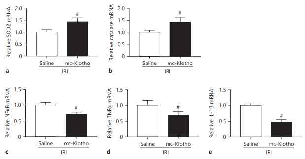 Effect of treatment with Klotho-encoding MC on the mRNA level of antioxidant genes and proinflammatory genes in an experimental mouse model of ischemia-reperfusion injury. qRTPCR analysis of SOD2 (a), catalase (b), NFκB (c), TNFα (d), and IL-1β (e) expression in kidney tissues. All results are representative of at least 3 independent experiments. # p < 0.05 vs. the other group. IRI, ischemia reperfusion injury; qRT-PCR, quantitative real-time polymerase chain reaction; MC, minicircle plasmid DNA