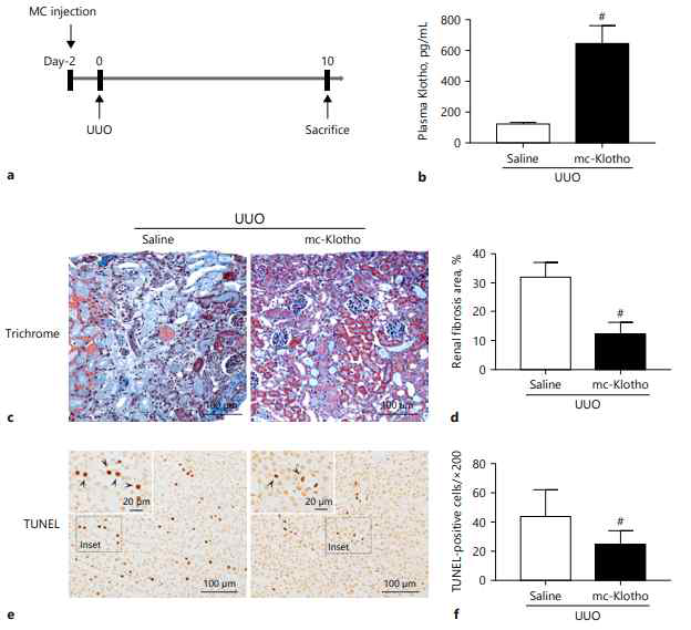 Effect of treatment with MCs, encoding Klotho, in an experimental UUO mouse model. a A diagram of the animal experiment to confirm the protective effect of mc-Klotho. Two days before UUO, mice were subjected to injection of either saline or mcKlotho via tail i.v. injection. b Plasma Klotho level by ELISA. c Representative images of kidney histology from cortex (Trichrome staining). d Percentage of renal fibrotic area. e Representative images of TUNEL staining. Arrows in inset indicate TUNEL-positives. f Quantification of TUNEL-positive cells. # p <0.05 vs. the other group. Scale bar = 100 μm. Inset scale bar = 20 μm. UUO, unilateral ureteral obstruction; MC, minicircle plasmid DNA; TUNEL, triphosphate nick end-labeling