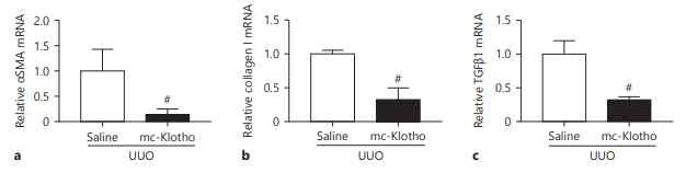 Effect of treatment with MCs, encoding Klotho, on the mRNA level of profibrotic genes in an experimental mouse model of UUO. qRT-PCR analysis of αSMA (a), collagen I (b), and TGFβ1 (c). All results are representative of at least 3 independent experiments. # p < 0.05 vs. the other group. UUO, unilateral ureteral obstruction; qRT-PCR, quantitative real-time polymerase chain reaction; MC, minicircle plasmid DNA