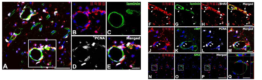 뇌손상 후 발생하는 혈관형성 (angiogenesis) 시 혈관마커에서 표적물질 발현 관찰