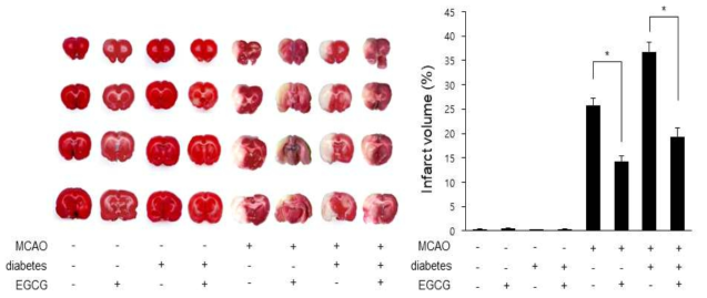 Representative photos and infarct volume of brain sections. Brain sections were stained by TTC (A). The ischemic area remained white, while the intact area was stained red. The percentage of ischemic lesion area was calculated as lesion area/whole brain section area