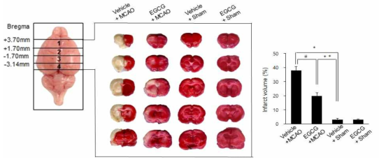 Representative photograph of TTC staining (A) and infarct volume (B) in vehicle + sham, epigallocatechin gallate (EGCG) + sham, vehicle + middle cerebral artery occlusion (MCAO), and EGCG + MCAO animals. Intact areas stained red, while ischemic areas remained white in color (A). Infarct volume was calculated as the ratio of infarct area to total brain area (B). EGCG attenuated MCAO-induced infarction. Data (n=4) are represented as mean ± S.E.M. * p < 0.01, ** p < 0.05 vs. vehicle + sham animals, # p < 0.05 vs. vehicle + MCAO animals