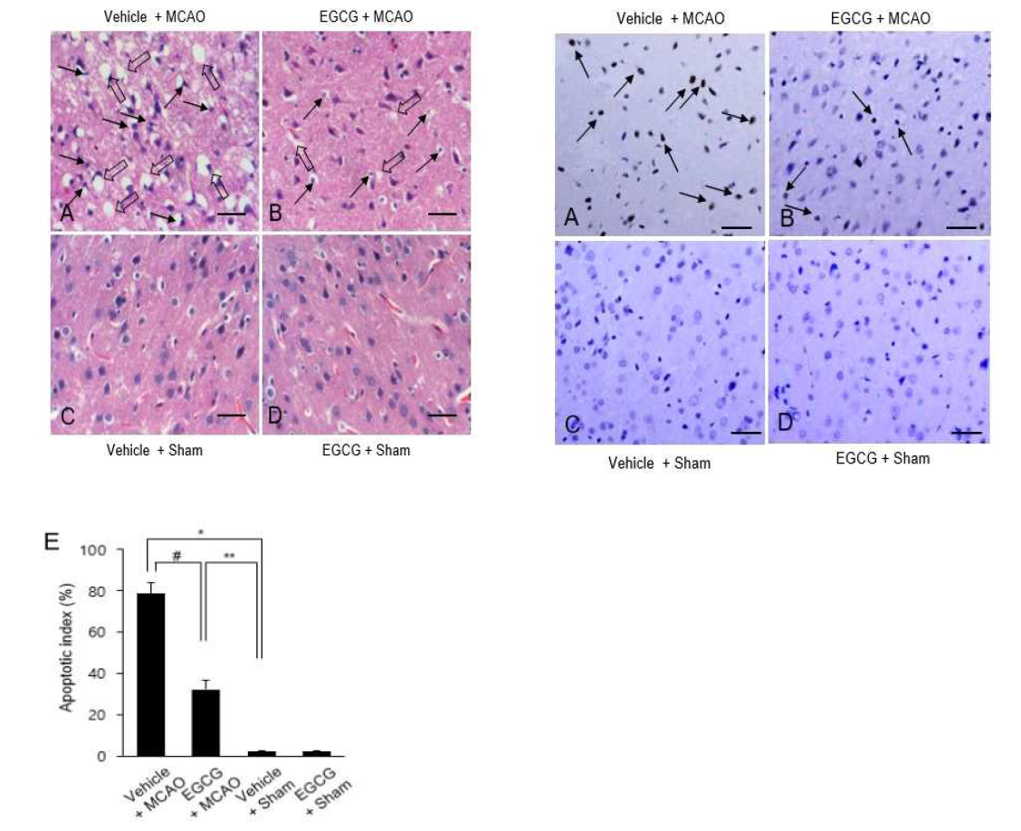 Representative photograph of hematoxylin and eosin staining and TUNEL staining in vehicle + sham, epigallocatechin gallate (EGCG) + sham, vehicle + middle cerebral artery occlusion (MCAO), and EGCG + MCAO animals. EGCG alleviated histopathological changes caused by MCAO. Filled arrows indicate shrunken and condensed nuclei, and open arrows indicate swelled and vacuolated forms. Scale bar = 100 μm. The number of TUNEL positive cells was markedly increased in vehicle + MCAO animals, while EGCG decreased the number of these positive cells. Arrows indicate cells with positive TUNEL staining. Scale bar: 100 μm. Apoptotic index indicates the percentage of TUNEL-positive cells to total cells. Data (n=4) are shown as mean ± S.E.M. * p < 0.01, ** p < 0.05 vs. vehicle + sham animals, # p < 0.05 vs. vehicle + MCAO animals