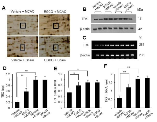 Image of thioredoxin (TRX) protein spots using proteomics (A, D), Western blot (B, E), and reverse transcription-PCR analyses (C, F) in vehicle + middle cerebral artery occlusion (MCAO), epigallocatechin gallate (EGCG) + MCAO, vehicle + sham, and EGCG + sham animals. Squares of A photos indicate TRX protein spot. TRX protein level is expressed as a ratio of spot intensity in each group relative to that in the vehicle + sham group. TRX protein and mRNA levels are expressed as the intensity of TRX to that of β-actin. Data (n=4) are shown as the mean ± S.D. * p < 0.01 and ** p < 0.001, two-way ANOVA followed by Scheffe’s test