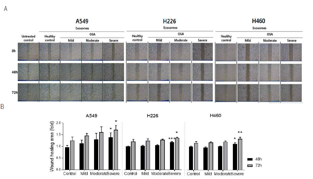 OSA 유래 엑소좀이 폐암세포의 이동능(migration)에 미치는 영향 (Data were represented as means ± SD. *p < 0.05, **p < 0.01 and ***p < 0.001 vs. Control by one-way ANOVA.)