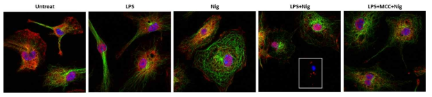 NLRP3 인플라마좀 활성에 의한 세포 내 SOD1 oligomer 확인