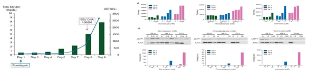 ENKTL 환자에서 romidepsin 에 따른 bilirubin 증가와 함께 EBV DNA 의 copy 수가 증가 (왼쪽) 와 SNK6 세포주에 romidepsin, PB, vorinostat을 시간과 농도별로 처리하였을 때, EBV DNA copy 수 변화와 LMP1 발현 확인