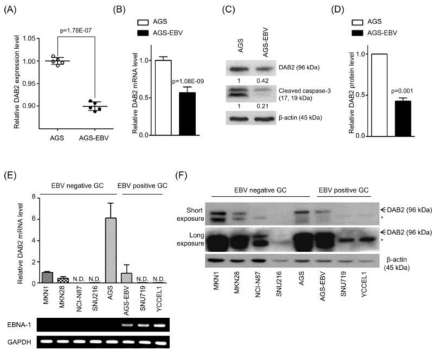 EBV에 감염된 위암 세포에서 DAB2 발현