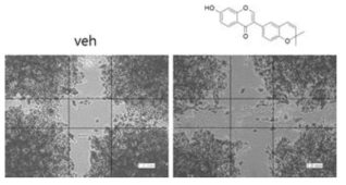 Effect of corylin on cell mobility in PANC-1 human pancreatic cancer cells