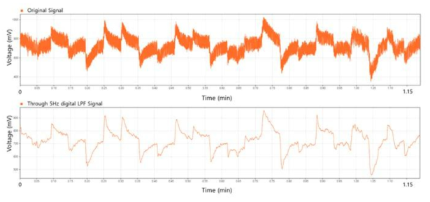 복합생체신호 획득회로를 통해 취득한 EOG신호 (a) 원신호 (b) 5Hz의 디지털 LPF를 거친 신호