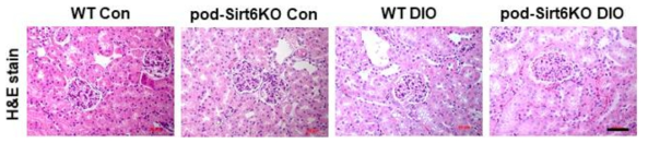 Representative H&E stain for control and diet induced obesity model (bar=50 μm)