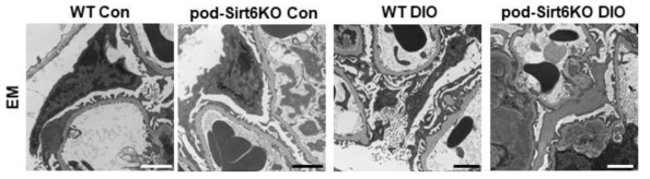 Representative electron microscopic findings for control and diet-induced obesity model (bar=2 μm)