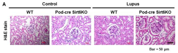 Representative H&E stain for lupus model in wild type and podocin-cre Sirt6 knock mouse