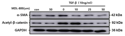 Western blot for α-SMA and acetyl-β-catenine in HK2 cells after treatment of TGF-β with or without Sirt6 activator, MDL-800