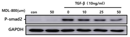 Western blot for p-Smad2 in NRK49F cells after treatment of TGF-β with or without Sirt6 activator, MDL-800