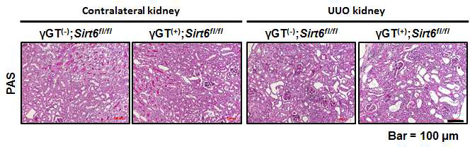PAS stain for kidney from γGT(-);Sirt6fl/fl and γGT(+);Sirt6fl/fl mouse