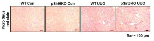 Representative Picro sirus red stain for UUO kidney in proximal tubule specific Sirt6KO mouse