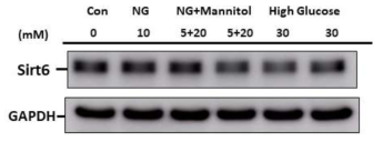 Western blot for Sirt6 in high glucose treated human podocytes