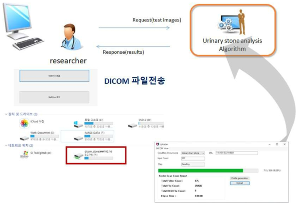 요로결석 자동진단 시스템 개요도