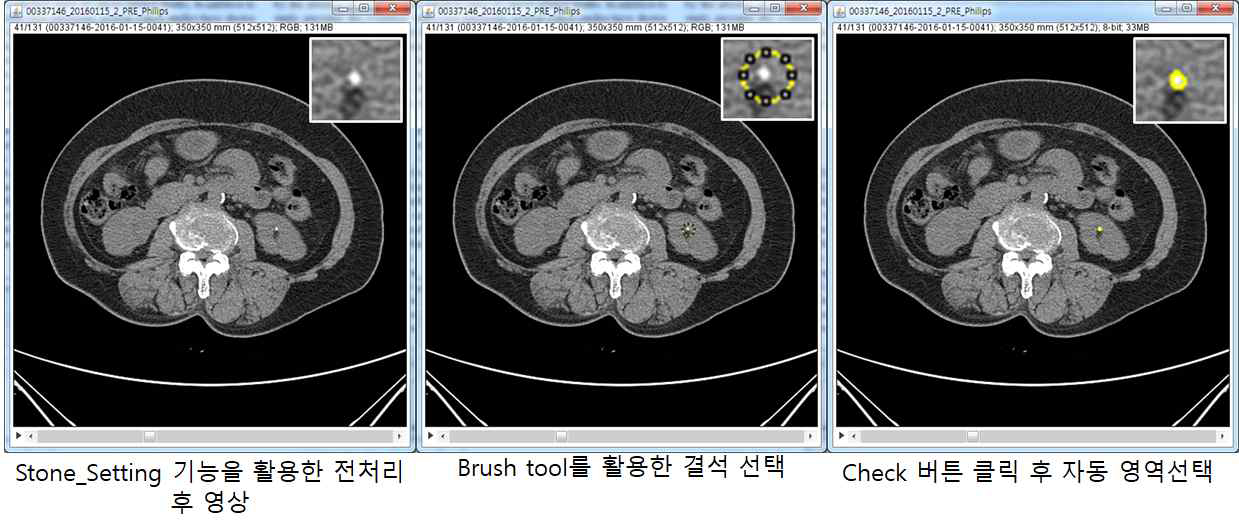 레이블링을 위한 소프트웨어의 전처리 및 결석 선택과 자동영역 선택 방법