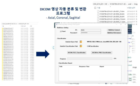 DICOM 영상 자동분류 및 변환 프로그램