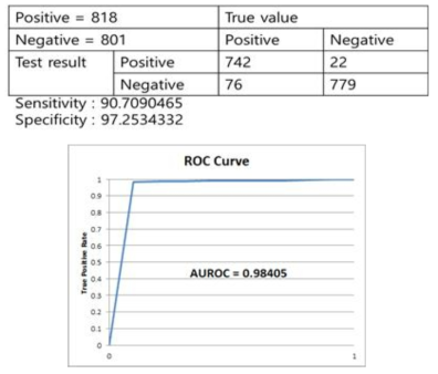 urinary stone 진단의 auroc 결과
