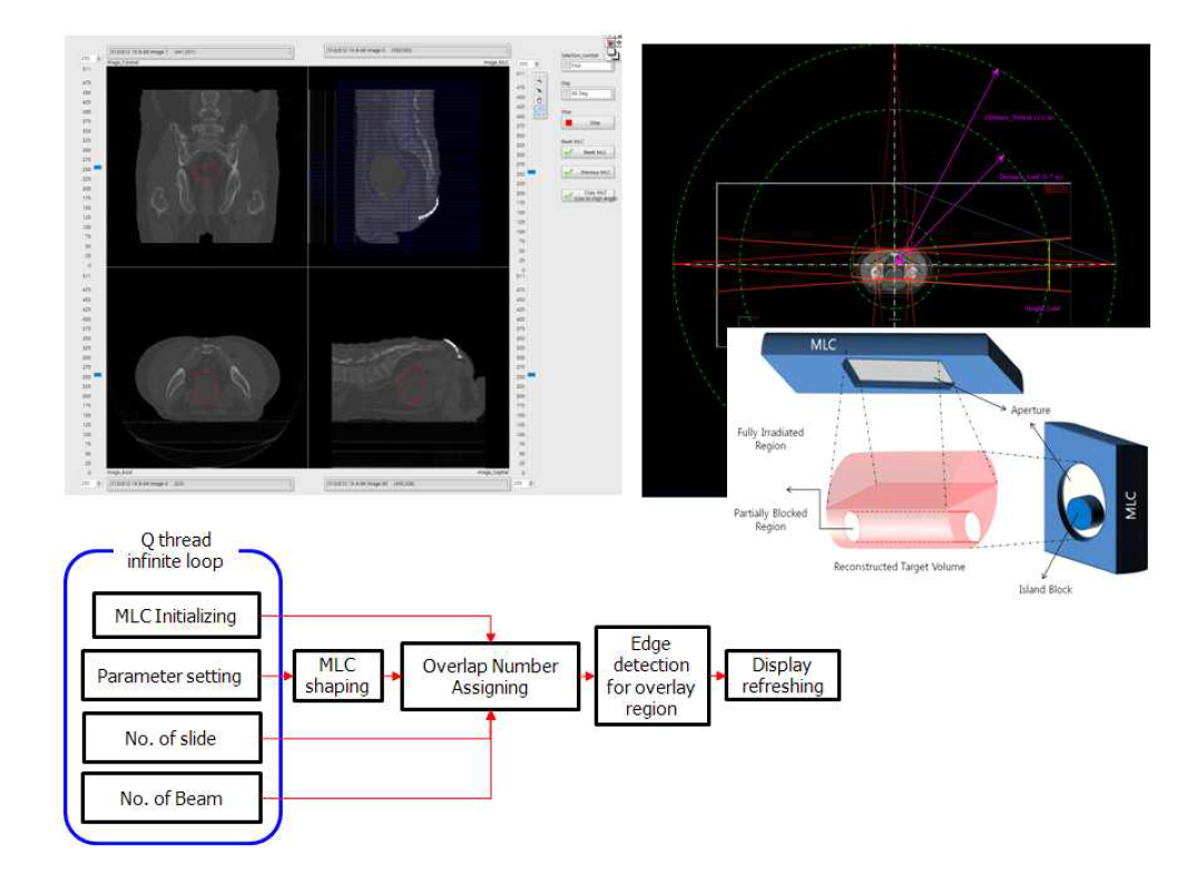 (좌상)구현된 프로그램의 Atuo-segmentation window. CT dicom 영상을 3차원 단면에서 display. 설정한 전달빔의 방향에서 형성된 빔의 시선 단명 영상에 MLC structure를 중첩시켜 전달영역을 자동구획하도록 설정. (우상) 임의 치료 빔 방향에서 자동 구획 영영을 설정하는 방법의 모식도. (하) 구현된 프로그램의 동작 방식 모식도