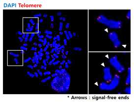환자 내시경 샘플 유래 오거노이드의 텔로미어 말단 분석