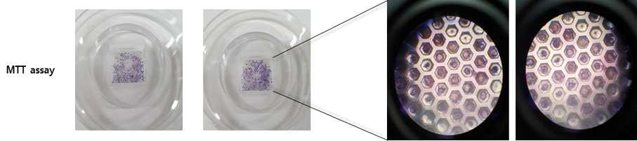 Microfluidic chip 기반의 오거노이드를 활용한 MTT assay 기법 확립