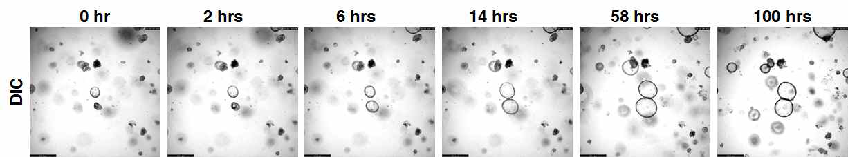 Live-cell imaging을 통해 KrasG12D 마우스 유래 췌장 오가노이드의 실시간 성장 과정 관찰