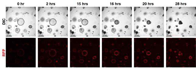 Live-cell imaging을 통해 신규 항암 물질 RN 처리 후 Reactive Oxygen Species(ROS) 형광 발현확인 결과