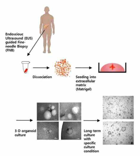 조직 검사 내시경 유래 환자 오거노이드의 배양 기법에 대한 모식도