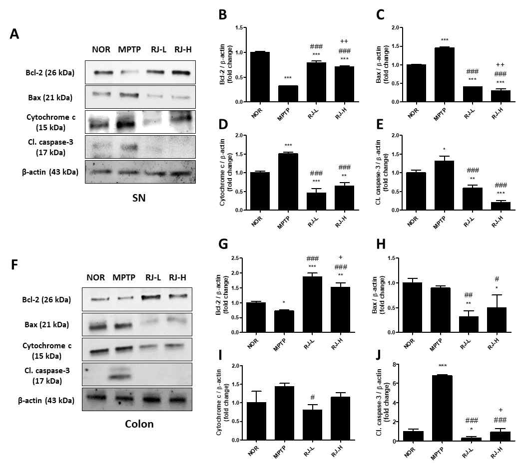 대장 및 SN조직의 apoptosis 관련 단백질 변화