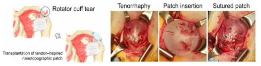 생분해성 힘줄 모사형 나노 지지체를 이용한 동물 모델 어깨 극상건 보강술
