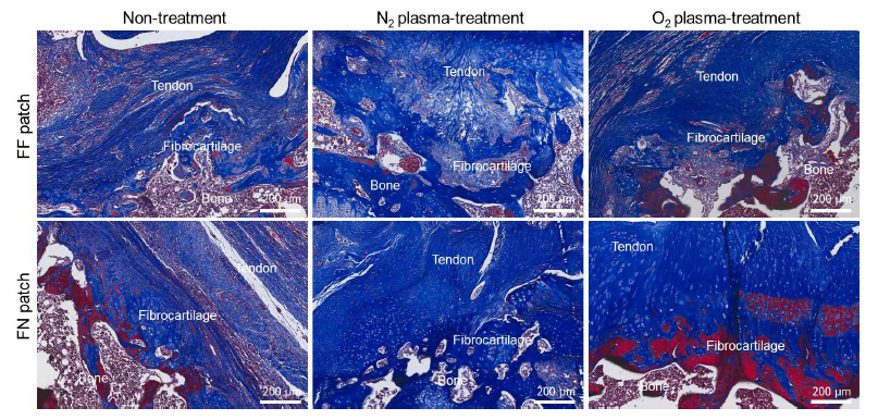 산소플라즈마 처리된 멀티스케일 패치의 만성 어깨 힘줄 재생 조직학적 평가 (H&T 염색)