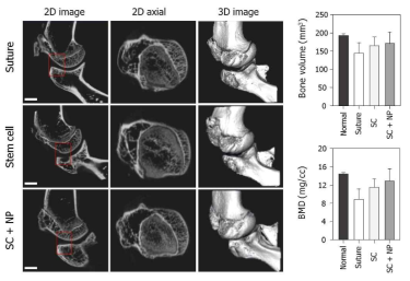 생분해성 힘줄 모사형 멀티스케일 패치의 힘줄 조직 재생 평가 후 토끼 상완골 두 대결절의 2차원, 3차원 골의 형태와 정량화 평가