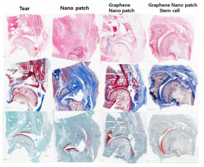 최적화된 그래핀 멀티스케일 패치의 토끼 어깨 힘줄 재생 조직학적 평가