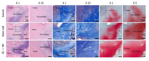 최적화된 멀티스케일 줄기세포 패치의 돼지 어깨 힘줄 재생 조직학적 평가