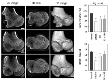 최적화된 줄기세포 멀티스케일 패치의 동물실험 (돼지) micro-CT 분석