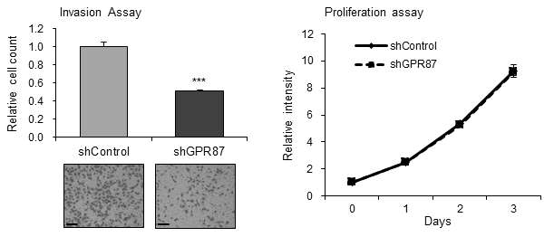 GPR87 억제에 의한 폐암세포의 증식과 침윤 변화