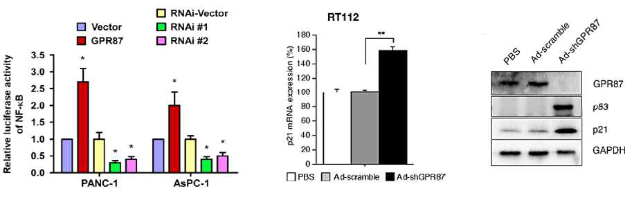 췌장암세포에서 GPR87의 발현에 따른 NF-κB, p21과 p53의 발현 변화 (Molecular Cancer, 2017, 16-61, Int. J. Mol. Sci., 2015,16, 24319-24331)